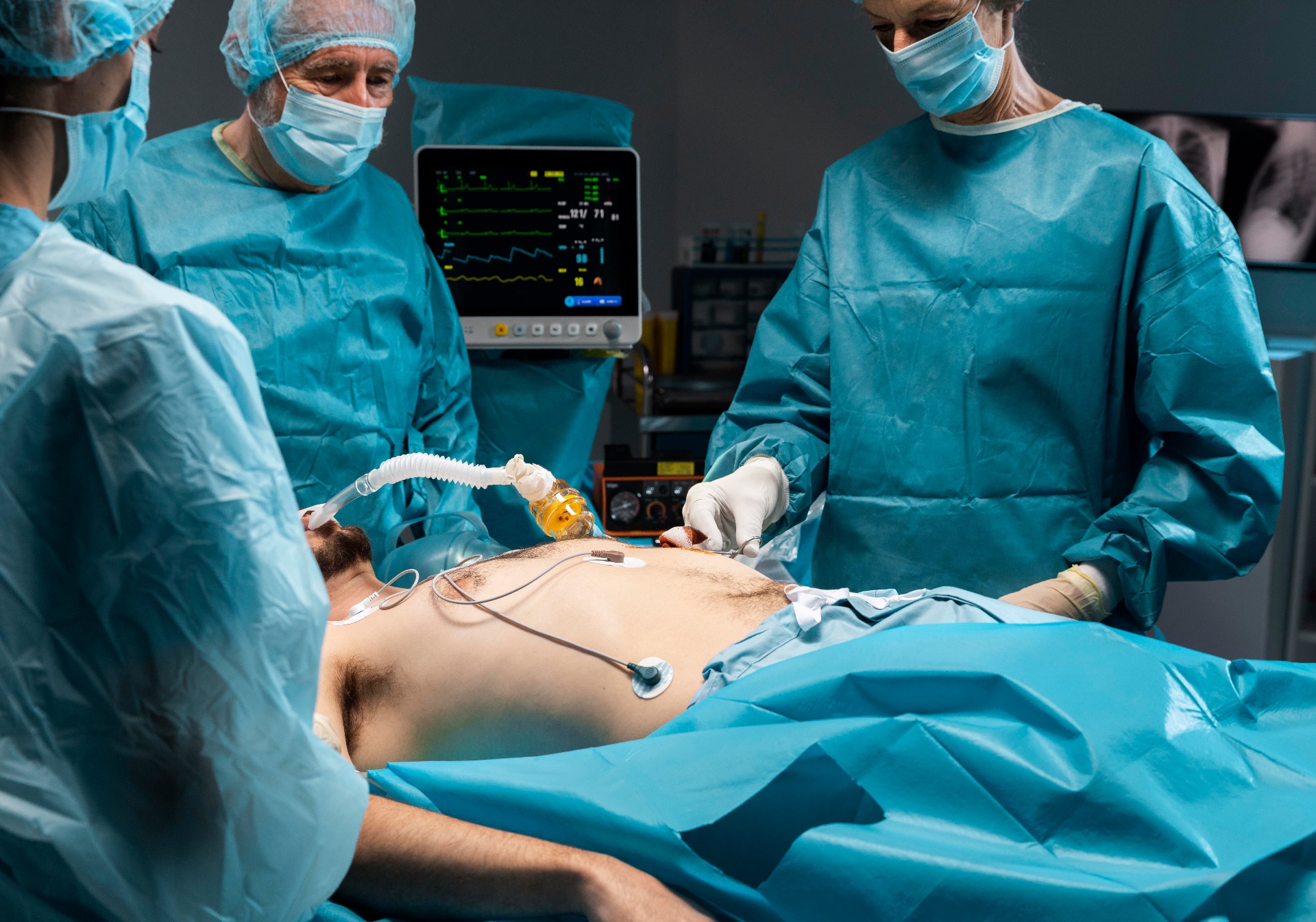 Laparoscopic Cholecystectomy